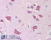 Anti-STK17B / DRAK2 Antibody (aa351-365) IHC-plus LS-B593
