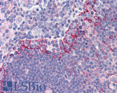 Anti-TLR6 Antibody (Internal) IHC-plus LS-B602