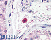 Anti-TNFRSF13B / TACI Antibody (N-Terminus) IHC-plus LS-B606