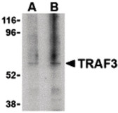 Anti-TRAF3 Antibody (C-Terminus) IHC-plus LS-B609