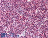 Anti-TSLP Antibody (C-Terminus) IHC-plus LS-B614