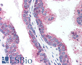 Anti-FIS1 Antibody IHC-plus LS-B627