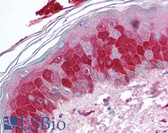 Anti-SPRR3 Antibody IHC-plus LS-B631