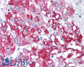 Anti-CD98 Antibody IHC-plus LS-B646