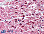 Anti-PPARG / PPAR Gamma Antibody (Internal) IHC-plus LS-B651