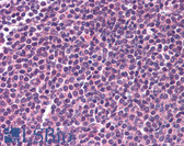 Anti-RELA / NFKB p65 Antibody (C-Terminus) IHC-plus LS-B653