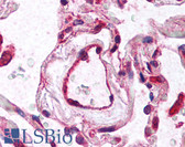 Anti-VEGFR-1/2 Antibody (aa800-900) IHC-plus LS-B668