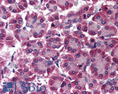 Anti-IREB2 / IRP2 Antibody (aa1-100) IHC-plus LS-B675