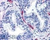 Anti-Nestin Antibody (aa1464-1614) IHC-plus LS-B678