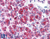 Anti-TLR3 Antibody (N-Terminus) IHC-plus LS-B687