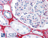 Anti-Collagen III Antibody IHC-plus LS-B693