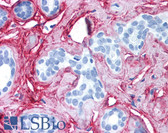 Anti-Collagen VI Antibody IHC-plus LS-B696