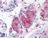 Anti-CIDEA / CIDE-A Antibody (aa200-217) IHC-plus LS-B703