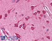 Anti-NFKBIA / IKB Alpha / IKBA Antibody (C-Terminus) IHC-plus LS-B717