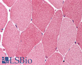 Anti-BCL10 / BCL-10 Antibody (aa5-19) IHC-plus LS-B746