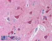 Anti-Gi Alpha 1/2 Antibody (aa345-354) IHC-plus LS-B750