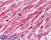 Anti-BMP2 Antibody (aa86-102) IHC-plus LS-B785