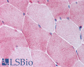 Anti-BMP3 Antibody (aa23-36) IHC-plus LS-B786