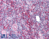 Anti-ABCB7 Antibody (aa733-747) IHC-plus LS-B791