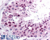 Anti-DNMT / DNMT1 Antibody (aa1603-1616) IHC-plus LS-B800