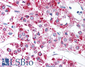 Anti-GDF15 Antibody (aa30-45) IHC-plus LS-B805