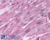 Anti-HAND1 Antibody (aa183-196) IHC-plus LS-B811