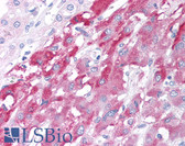 Anti-HAP1 Antibody (aa639-653) IHC-plus LS-B813