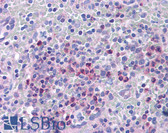 Anti-ITGB1BP1 / ICAP1 Antibody (aa92-105) IHC-plus LS-B815