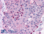 Anti-MMP28 Antibody (aa298-312) IHC-plus LS-B854