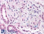 Anti-PRKACB Antibody (phospho-Thr198) IHC-plus LS-B860