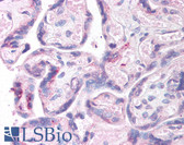 Anti-MAGEL2 Antibody (aa514-529) IHC-plus LS-B864