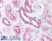 Anti-Pyrin / MEFV / MEF Antibody (aa268-284) IHC-plus LS-B865