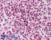 Anti-MLLT6 Antibody (aa1071-1086) IHC-plus LS-B872