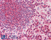 Anti-MMP16 Antibody (aa169-183) IHC-plus LS-B875