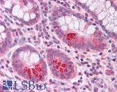 Anti-MMP17 Antibody (aa409-423) IHC-plus LS-B876