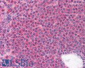 Anti-LRRC3B Antibody (aa245-259) IHC-plus LS-B880