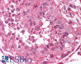 Anti-MAGEA1 / MAGE 1 Antibody (aa158-174) IHC-plus LS-B881