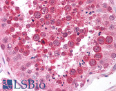 Anti-MAGE12 / MAGEA12 Antibody (aa96-108) IHC-plus LS-B882