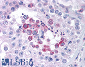 Anti-MAGEA3 Antibody (aa298-314) IHC-plus LS-B884