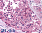 Anti-MAGEA4 Antibody (aa24-38) IHC-plus LS-B885