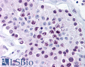 Anti-MAGEA6 Antibody (aa229-243) IHC-plus LS-B886