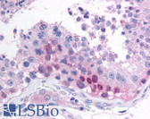 Anti-MAGEB2 Antibody (aa19-33) IHC-plus LS-B889