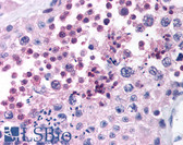 Anti-MAGEB3 Antibody (aa47-61) IHC-plus LS-B890