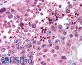Anti-MAGEB4 Antibody (aa140-155) IHC-plus LS-B891