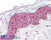 Anti-SHSF1 / SHFM1 Antibody (aa57-70) IHC-plus LS-B899