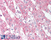 Anti-SIRT6 / Sirtuin 6 Antibody (aa305-320) IHC-plus LS-B900
