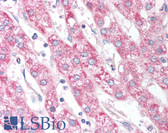 Anti-SMYD5 Antibody (aa355-371) IHC-plus LS-B902