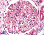 Anti-ST7 Antibody (aa846-859) IHC-plus LS-B906