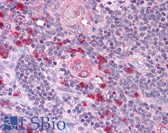 Anti-TAP2 Antibody (aa689-703) IHC-plus LS-B907