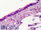 Anti-TBX4 Antibody (aa529-545) IHC-plus LS-B910
